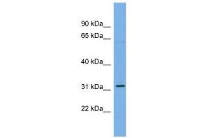 CDCA5 antibody used at 1 ug/ml to detect target protein.