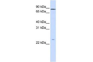 GPSM2 antibody used at 1 ug/ml to detect target protein.