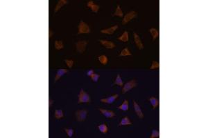 Immunofluorescence analysis of L929 cells using ENAH antibody (ABIN7266936) at dilution of 1:100. (ENAH antibody  (AA 412-591))