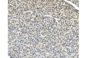 IHC analysis of AKR1D1 using anti-AKR1D1 antibody (ABIN7602975). (AKR1D1 antibody  (Middle Region))