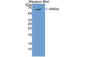 Detection of Recombinant F11, Rat using Polyclonal Antibody to Coagulation Factor XI (F11) (Factor XI antibody  (AA 275-516))