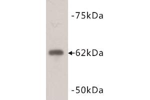 Western Blotting (WB) image for anti-PiggyBac Transposable Element Derived 5 (PGBD5) antibody (ABIN1854961)