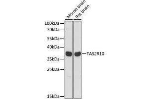 Western blot analysis of extracts of various cell lines, using TR10 antibody (ABIN7270735) at 1:1000 dilution. (TAS2R10 antibody  (AA 100-200))
