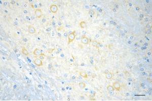 Immunohistochemistry was performed on paraffin-embedded mouse brain using ELP4 antibody (ABIN7798433), 1:200). (Recombinant ELP4 antibody)