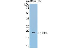 Western blot analysis of the recombinant protein. (LCAT antibody  (AA 290-432))