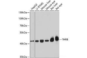 Western blot analysis of extracts of various cell lines using THRB Polyclonal Antibody at dilution of 1:1000. (THRB antibody)