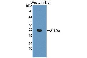Figure. (PLCB3 antibody  (AA 318-468))