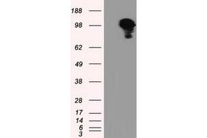 Image no. 3 for anti-Transforming, Acidic Coiled-Coil Containing Protein 3 (TACC3) antibody (ABIN1498099) (TACC3 antibody)