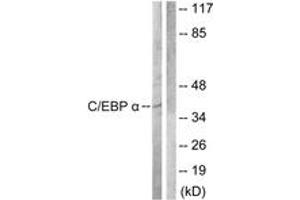 Western blot analysis of extracts from COS7 cells, treated with EGF 200ng/ml 30', using C/EBP-alpha (Ab-222) Antibody. (CEBPA antibody  (AA 192-241))