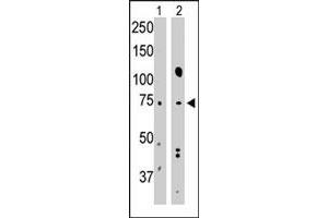 The BMPR1A polyclonal antibody  is used in Western blot to detect BMPR1A in mouse muscle tissue lysate (Lane 1) and Hela cell lysate (Lane 2) . (BMPR1A antibody  (N-Term))
