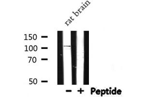 Western blot analysis of NOD1 expression in Rat brain lysate (NOD1 antibody  (C-Term))