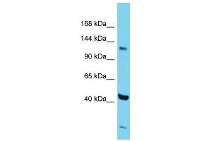 Host:  Rabbit  Target Name:  Zfp445  Sample Type:  Mouse Testis lysates  Antibody Dilution:  1.