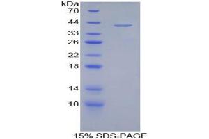 SDS-PAGE analysis of Human Corin Protein.
