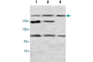 Western blot analysis of rat brain (Lane 1), rat testis (Lane 2) and human fetal kidney (Lane 3) lysate with PLXNB1 polyclonal antibody  at 1 : 500 dilution.