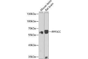 Western blot analysis of extracts of various cell lines, using PPP3CC antibody (ABIN6131416, ABIN6146099, ABIN6146100 and ABIN6223644) at 1:1000 dilution. (PPP3CC antibody  (AA 373-512))