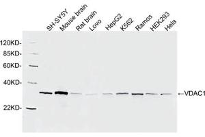 Western blot analysis of cell and tissue lysates using 1 µg/mL Rabbit Anti-VDAC1 Polyclonal Antibody (ABIN398895) The signal was developed with IRDyeTM 800 Conjugated Goat Anti-Rabbit IgG.
