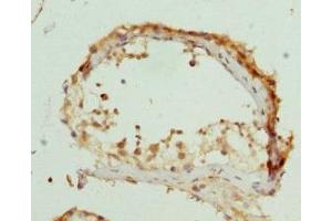 Immunohistochemistry of paraffin-embedded human testis tissue using ABIN7162541 at dilution of 1:100 (ZDHHC17 antibody  (AA 170-310))