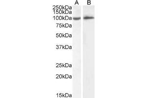 ABIN5539625 (2µg/ml) staining of HeLa (A) and Daudi (B) cell lysate (35µg protein in RIPA buffer). (ICAM1 antibody  (Internal Region))