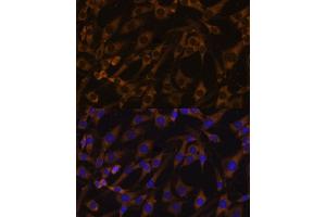Immunofluorescence analysis of C6 cells using EIF5B antibody (ABIN7267052) at dilution of 1:100. (EIF5B antibody  (AA 1-273))