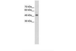 Image no. 1 for anti-CUE Domain Containing 1 (CUEDC1) (AA 251-300) antibody (ABIN203464) (CUEDC1 antibody  (AA 251-300))