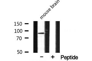 Western blot analysis of extracts from mouse brain, using CAGE1 antibody. (CAGE1 antibody  (C-Term))