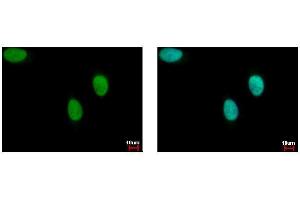 ICC/IF Image FANCJ antibody [N1N2], N-term detects BRIP1 protein at cytoplasm by immunofluorescent analysis. (BRIP1 antibody  (N-Term))