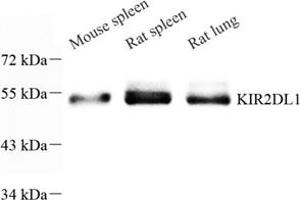 Western blot analysis of KIR2DL1 (ABIN7074433) at dilution of 1: 1600 (KIR2DL1 antibody)