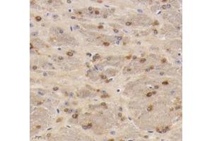 Immunohistochemistry (Paraffin-embedded Sections) (IHC (p)) image for anti-Solute Carrier Family 18 (Vesicular Monoamine Transporter), Member 2 (SLC18A2) antibody (ABIN7075655)
