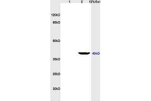 Lane 1: rat heart lysates Lane 2: rat brain lysates probed with Anti LTB4-R2 Polyclonal Antibody, Unconjugated (ABIN748643) at 1:200 in 4 °C. (LTB4R2 antibody  (AA 25-120))
