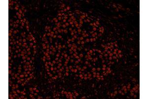 Immunofluorescence (IF) image for anti-Histone Deacetylase 2 (HDAC2) (C-Term) antibody (ABIN7448973) (HDAC2 antibody  (C-Term))
