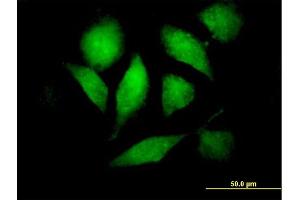 Immunofluorescence of purified MaxPab antibody to RAF1 on HeLa cell. (RAF1 antibody  (AA 1-648))