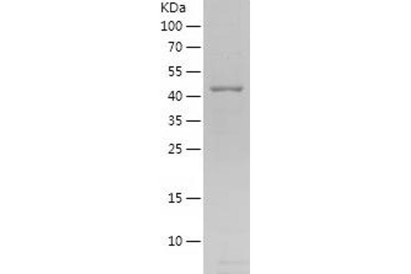 PROX1 Protein (AA 354-737) (His tag)