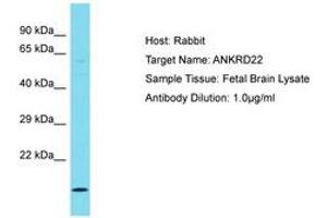 Image no. 1 for anti-Ankyrin Repeat Domain 22 (ANKRD22) (AA 48-97) antibody (ABIN6750744) (ANKRD22 antibody  (AA 48-97))