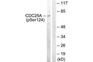Western blot analysis of extracts from 293 cells treated with UV 15', using CDC25A (Phospho-Ser124) Antibody. (CDC25A antibody  (pSer124))