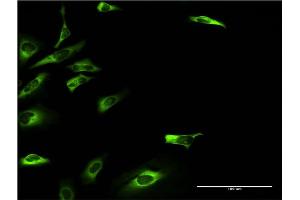 Immunofluorescence of monoclonal antibody to KHK on HeLa cell. (Ketohexokinase antibody  (AA 1-298))