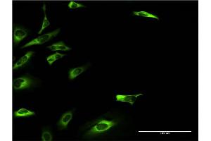Immunofluorescence of monoclonal antibody to KHK on HeLa cell.
