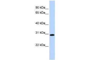 SMNDC1 antibody used at 1 ug/ml to detect target protein. (SMNDC1 antibody  (Middle Region))