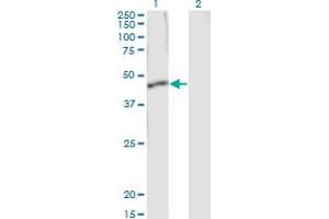 Western Blot analysis of SERPINB1 expression in transfected 293T cell line by SERPINB1 monoclonal antibody (M01), clone 4A7. (SERPINB1 antibody  (AA 1-379))