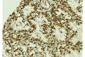 ABIN6279800 at 1/100 staining Human lung tissue by IHC-P. (SRPK2 antibody)