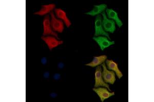 ABIN6260641 and ABIN6268823 staining Hela cells by IF/ICC.