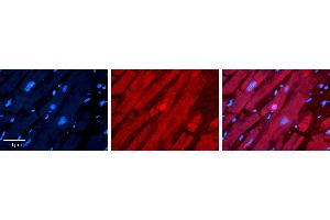 Rabbit Anti-TSG101 Antibody   Formalin Fixed Paraffin Embedded Tissue: Human heart Tissue Observed Staining: Cytoplasmic, nucleus Primary Antibody Concentration: 1:100 Other Working Concentrations: N/A Secondary Antibody: Donkey anti-Rabbit-Cy3 Secondary Antibody Concentration: 1:200 Magnification: 20X Exposure Time: 0. (TSG101 antibody  (N-Term))