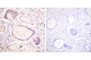 P-peptide - + (Cyclin B1 antibody  (pSer147))