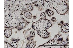 Image no. 1 for anti-Diacylglycerol Kinase, alpha 80kDa (DGKA) (AA 1-736) antibody (ABIN599366) (DGKA antibody  (AA 1-736))