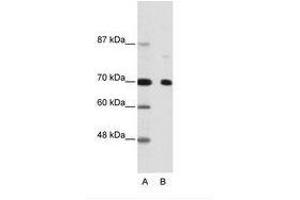 Image no. 1 for anti-Nuclear Receptor Co-Repressor 2 (NCOR2) (AA 541-590) antibody (ABIN202991) (NCOR2 antibody  (AA 541-590))