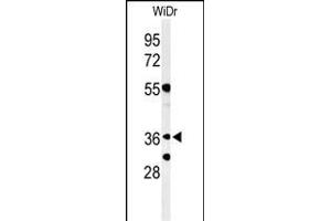 Western blot analysis of NSE4A Antibody (N-term) (ABIN653864 and ABIN2843120) in WiDr cell line lysates (35 μg/lane). (NSMCE4A antibody  (N-Term))