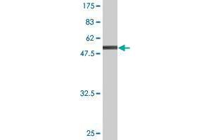 Western Blot detection against Immunogen (57. (SNX6 antibody  (AA 1-290))