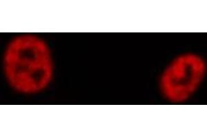 ABIN6274193 staining Hela cells by IF/ICC. (TFE3 antibody  (Internal Region))