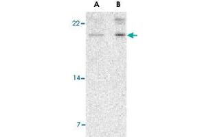 Western blot analysis of AES in 293 cell lysate with AES polyclonal antibody  at (A) 2 and (B) 4 ug/mL .
