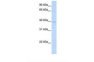 Image no. 1 for anti-Potassium Channel Modulatory Factor 1 (KCMF1) (AA 71-120) antibody (ABIN6737700) (KCMF1 antibody  (AA 71-120))