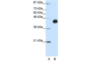 Cytokeratin 18 antibody used at 1. (Cytokeratin 18 antibody  (N-Term))